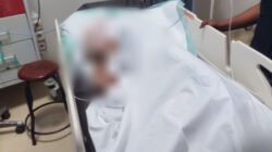 Seorang Pria di Mimika Terluka Parah usai Tantang Duel dengan Tetangga